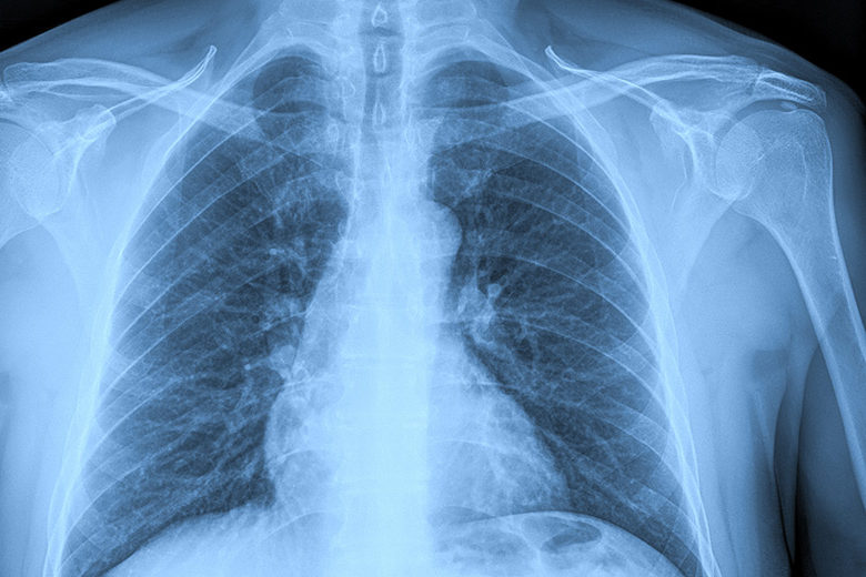 Aquifer-Website-Featured-Images Aquifer Radiology